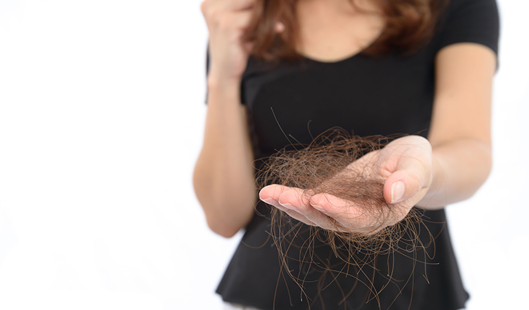 Can Iron Deficiency Cause Hair Loss Image 1 768 X 450 0 